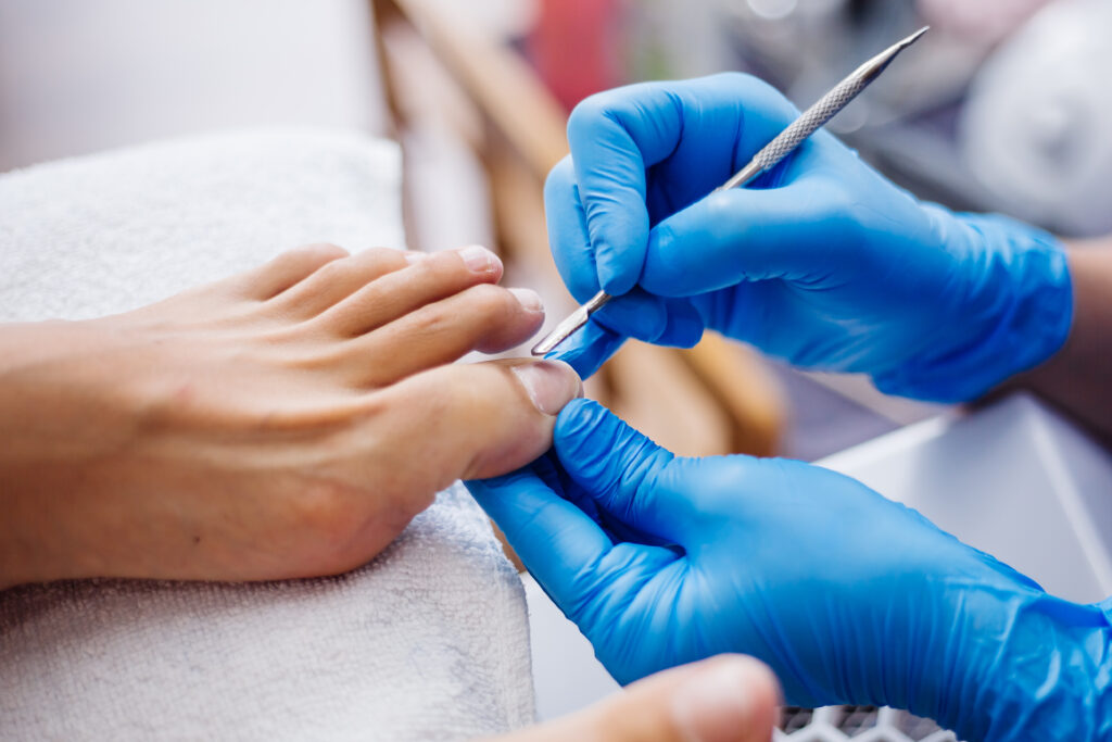 Pedicure Nieuwegein, medisch pedicure Nieuwegein, professionele behandeling aan voeten, Plus Voetzorg